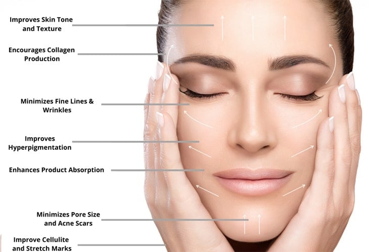 Aftercare Tips for Microneedling: Maintaining Your Results with Baskin Aesthetics in Portland, ME