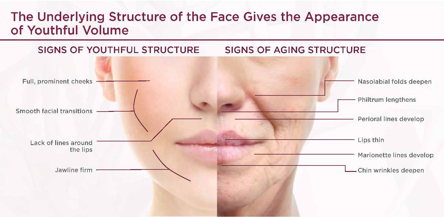 Underlying-Structure