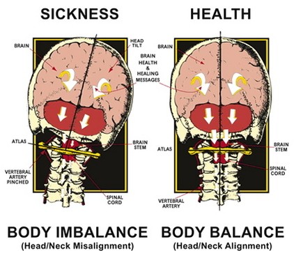 BodyImbalance